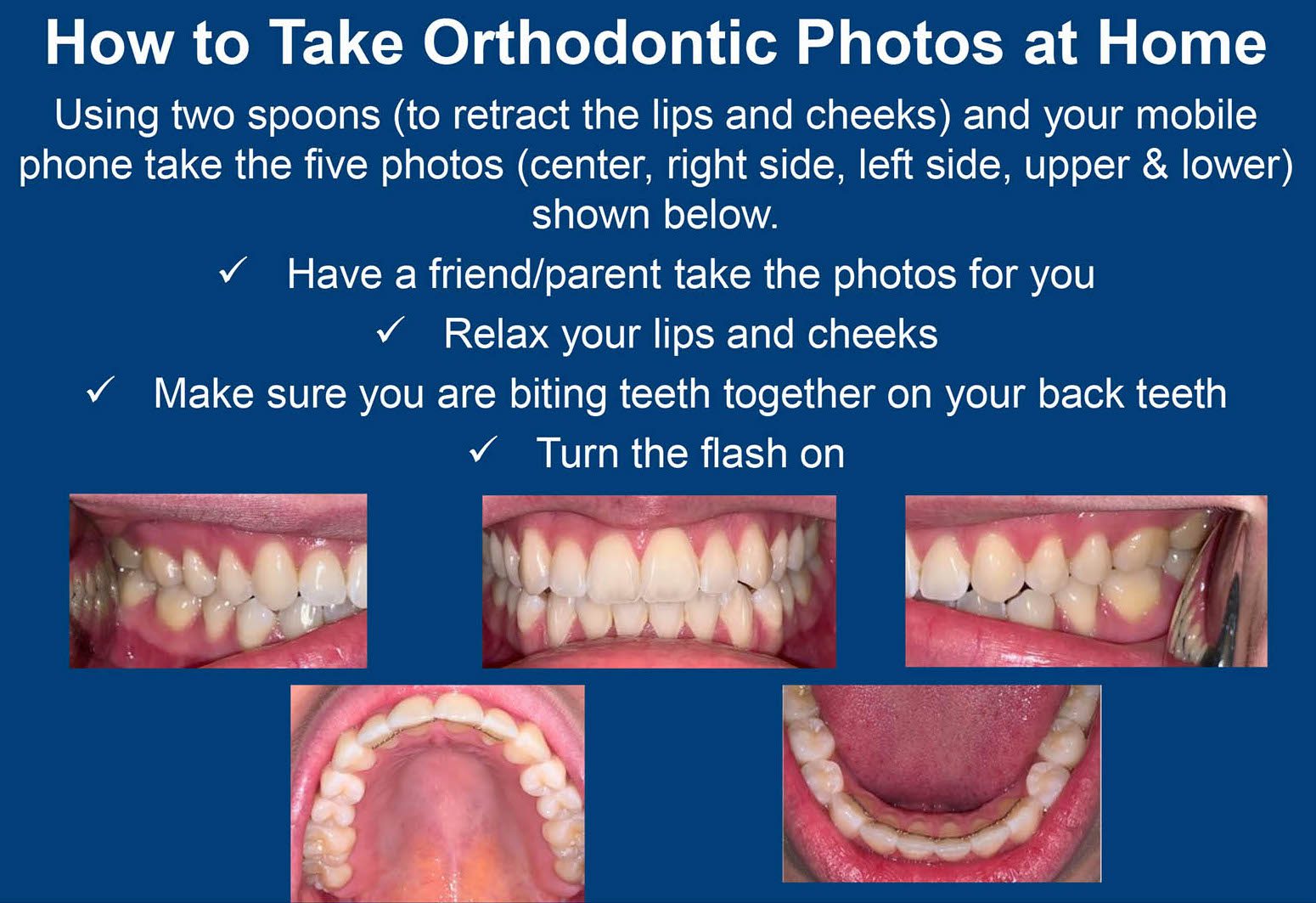 How to Take Orthodontic Photos at Home
